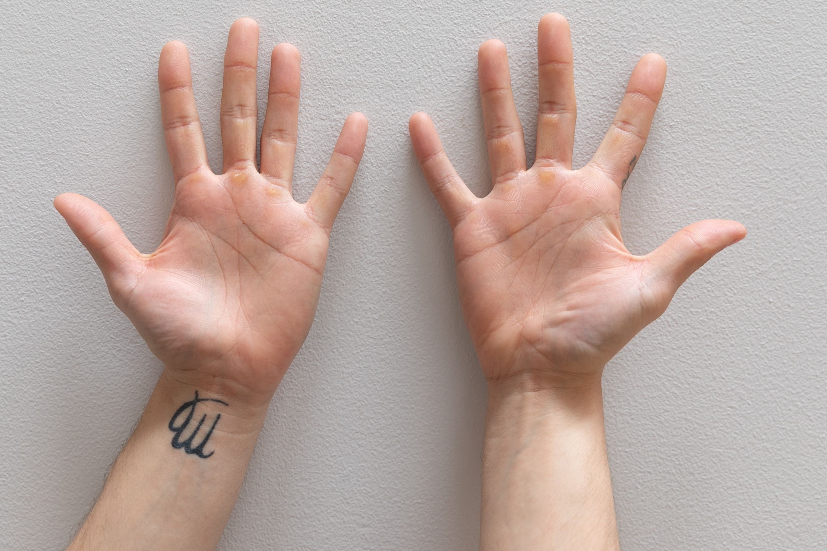 Hand Talent