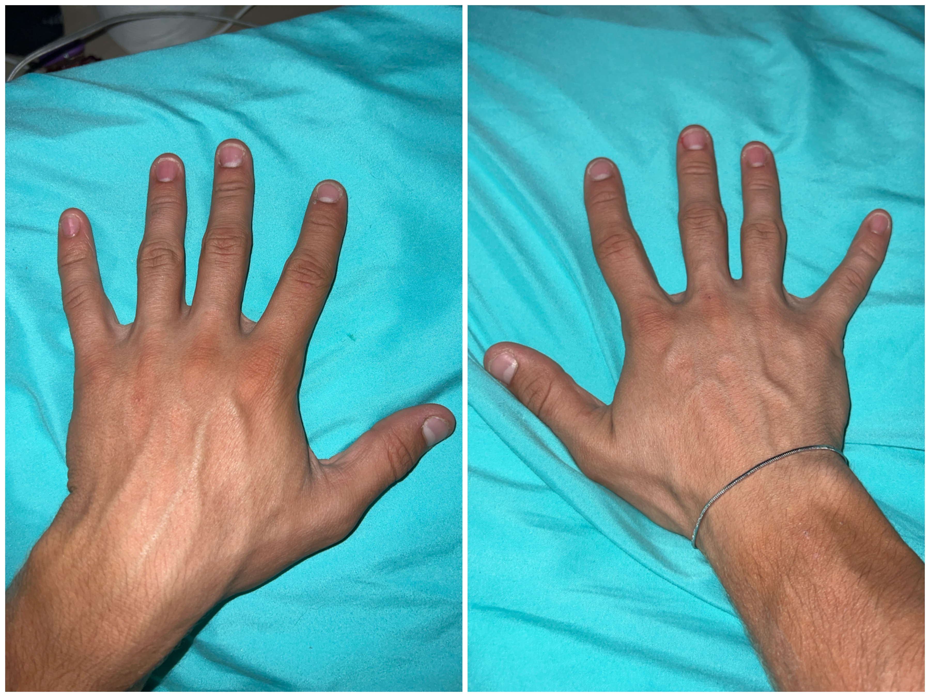 Hand Talent