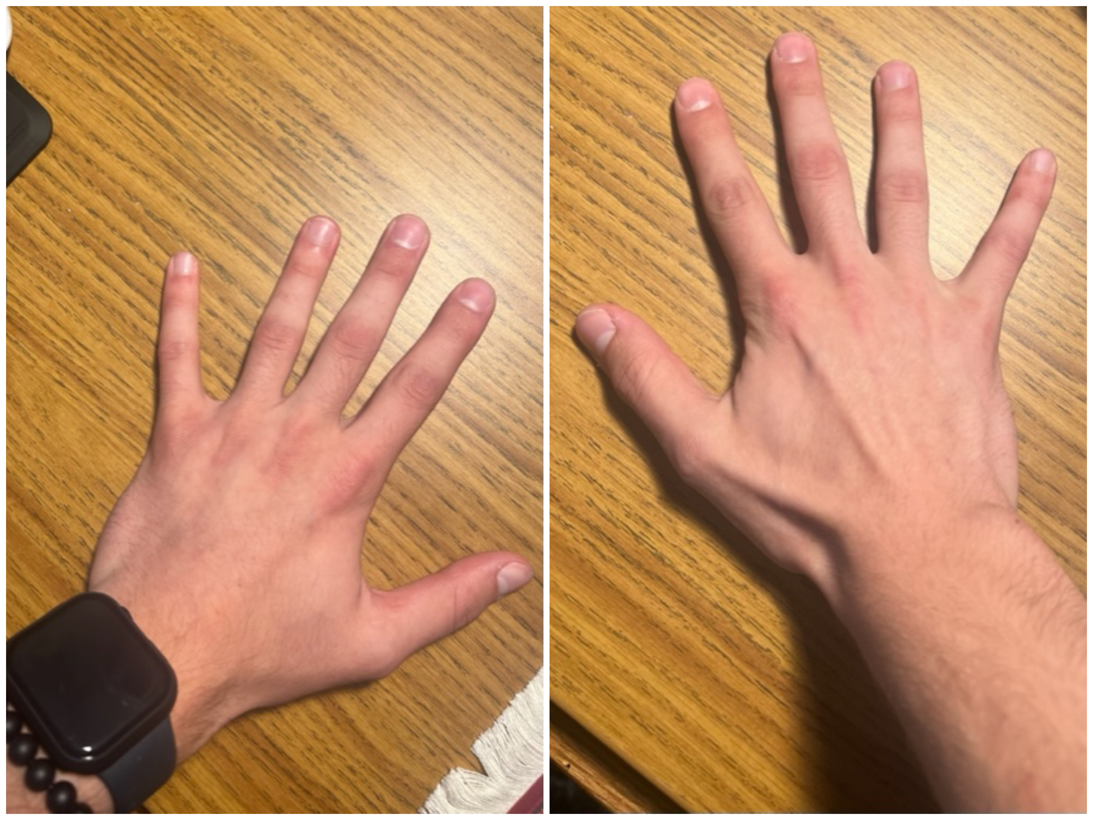 Hand Talent
