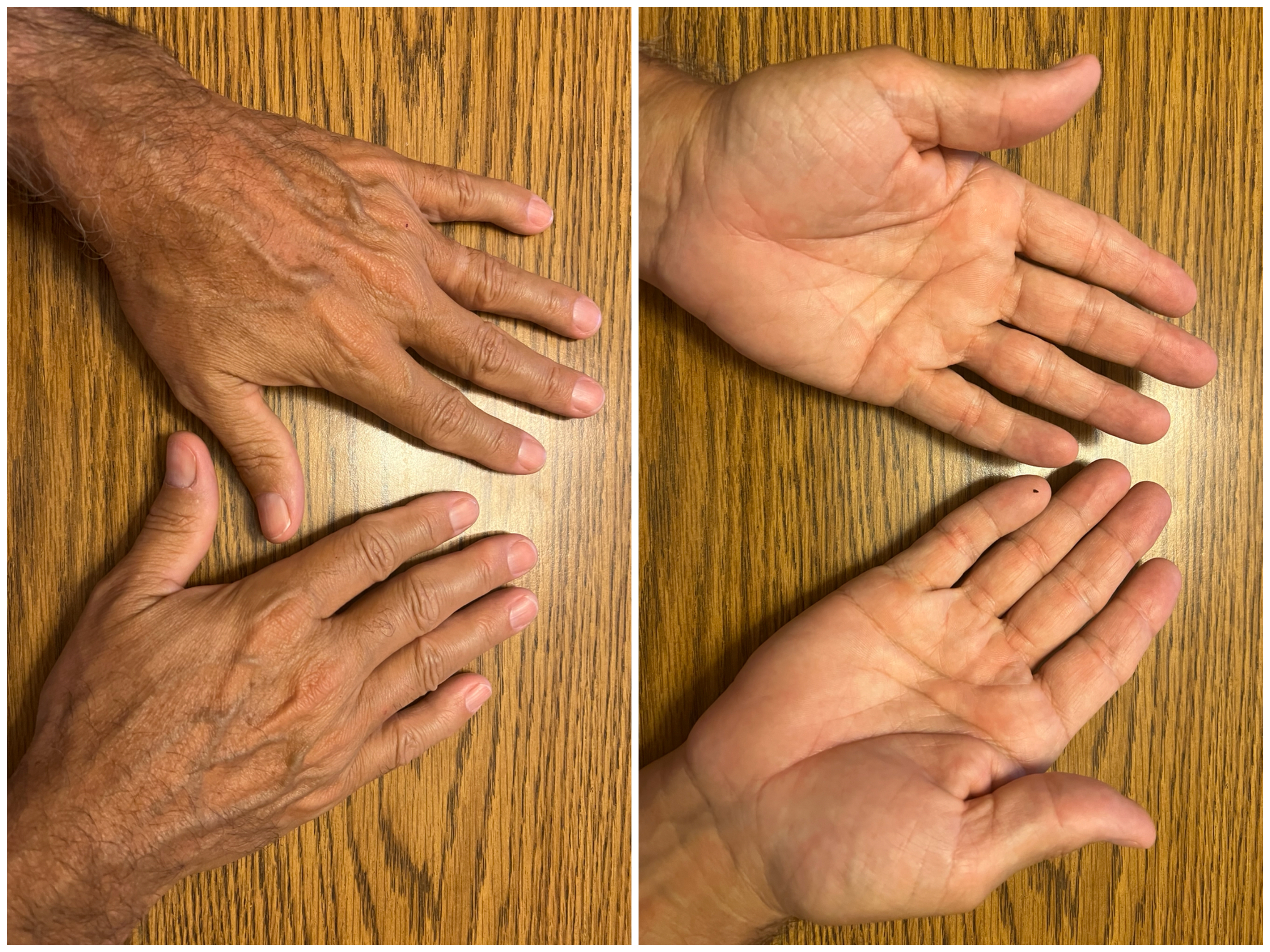 Hand Talent