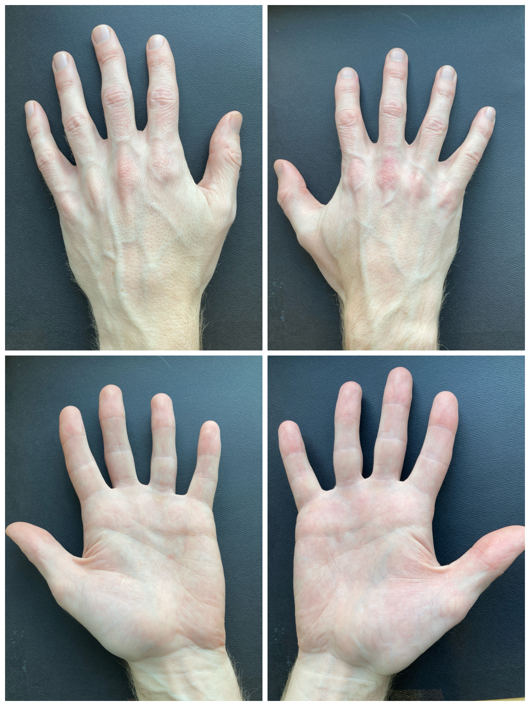 Hand Talent