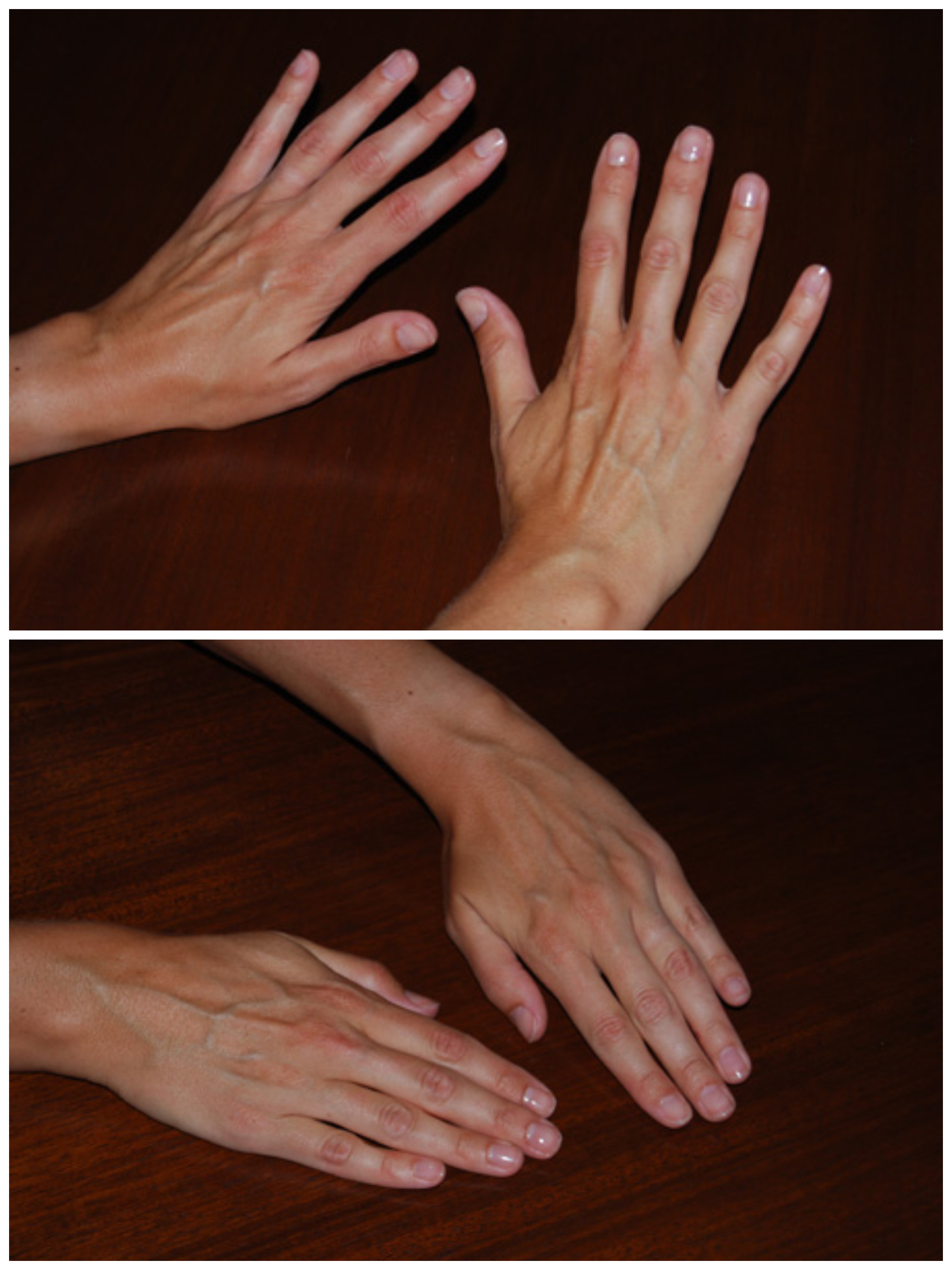 Hand Talent