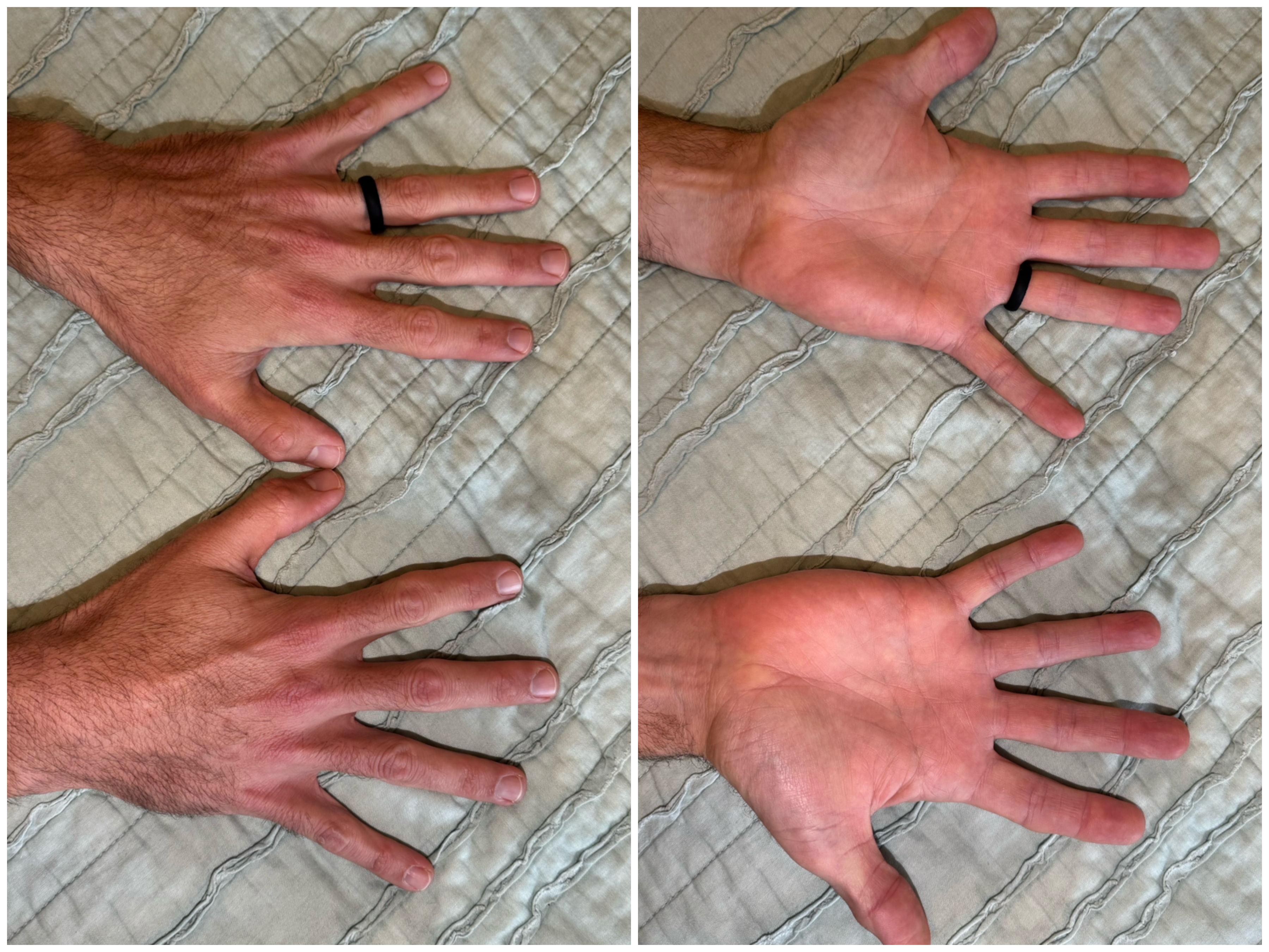 Hand Talent