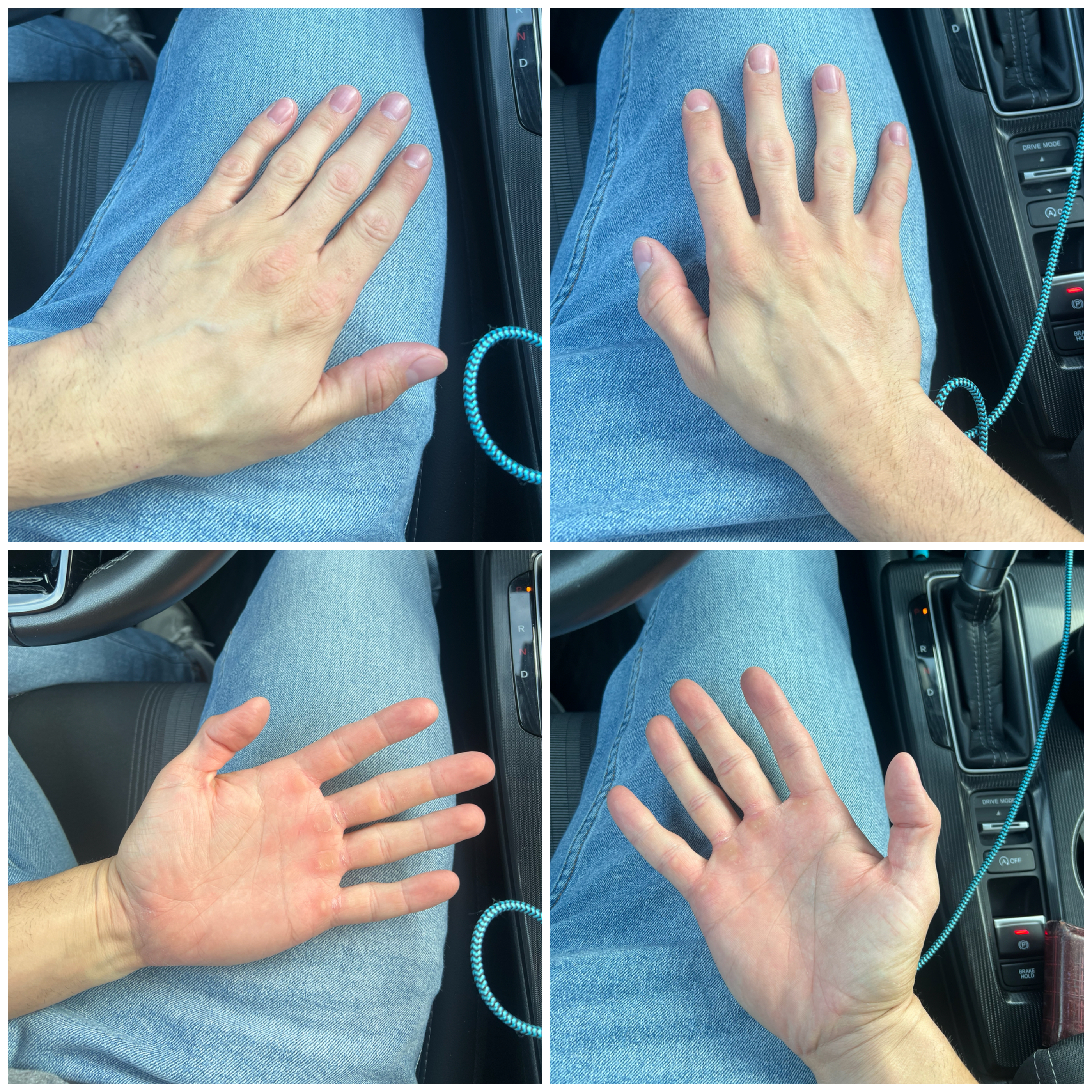 Hand Talent