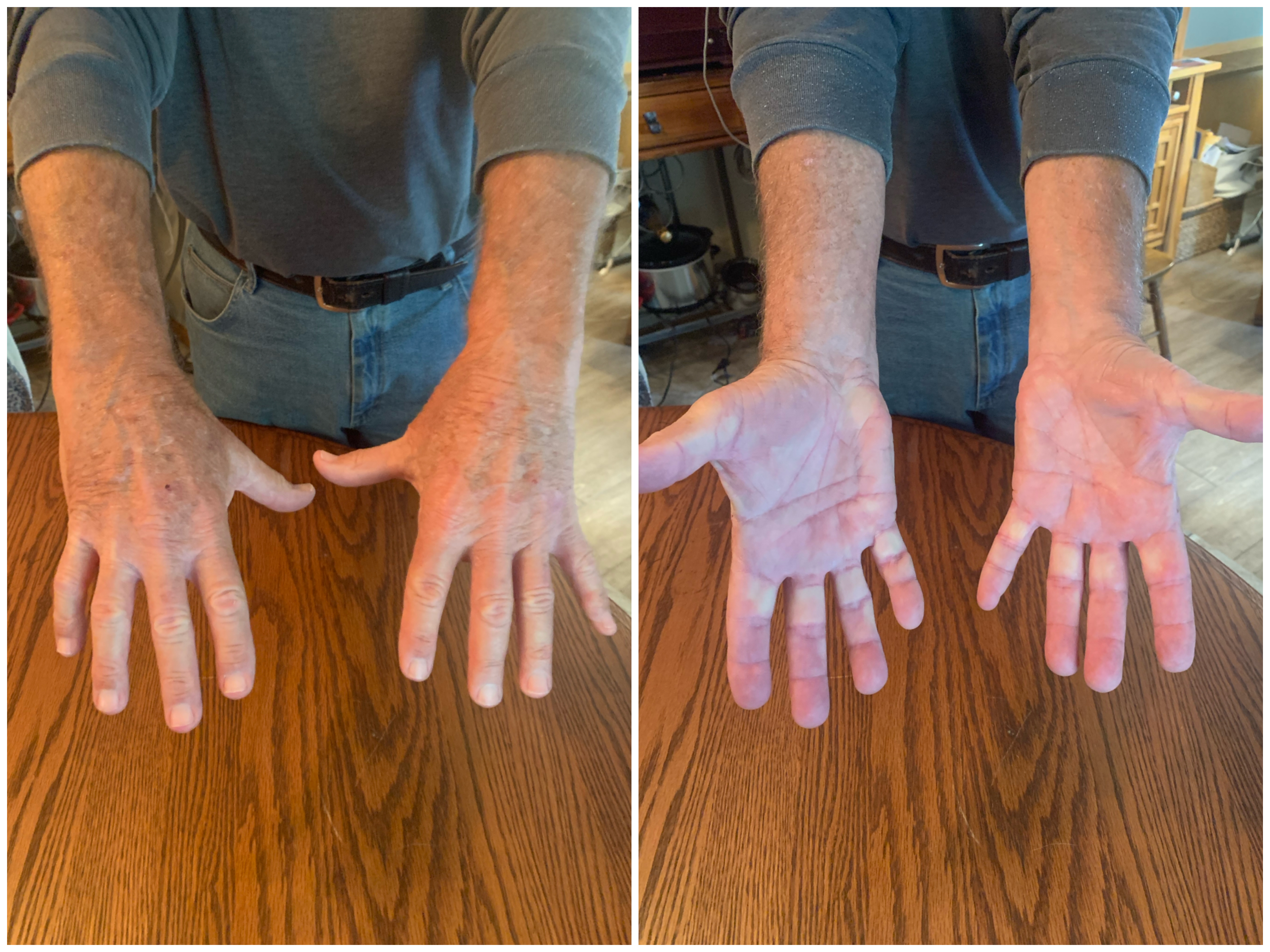 Hand Talent