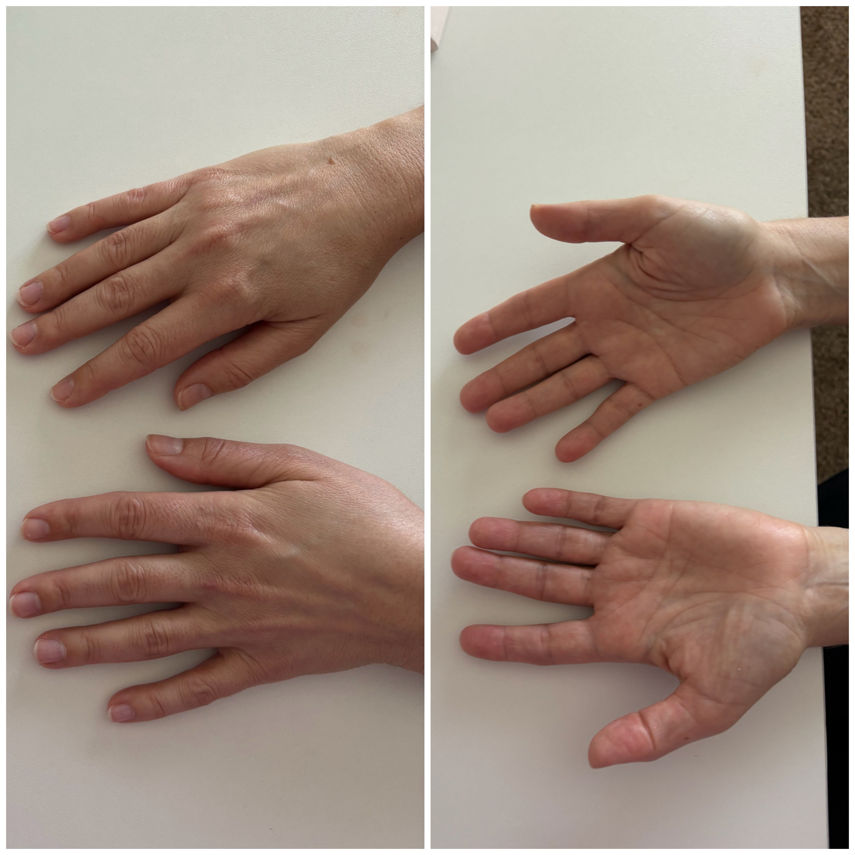 Hand Talent