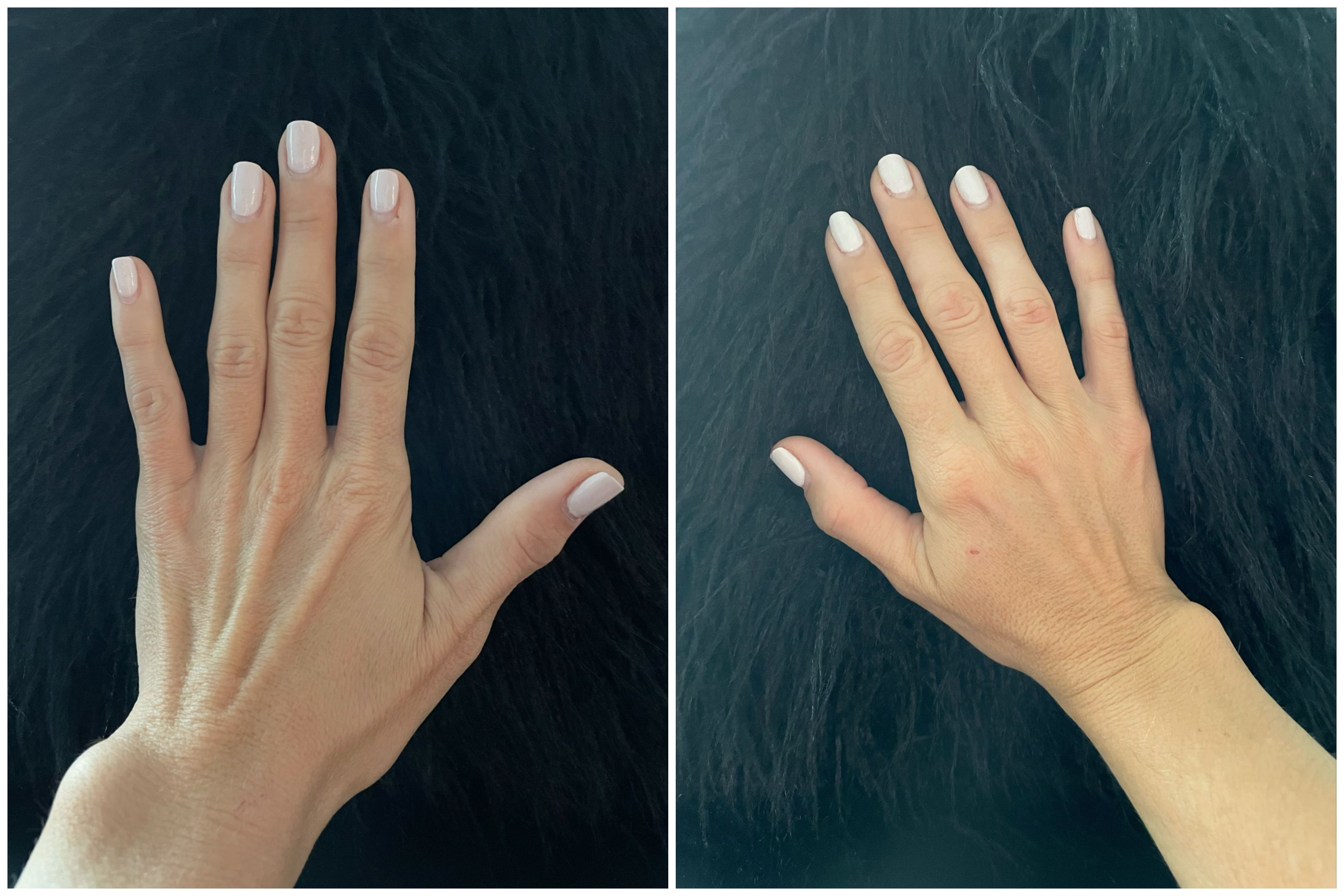 Hand Talent
