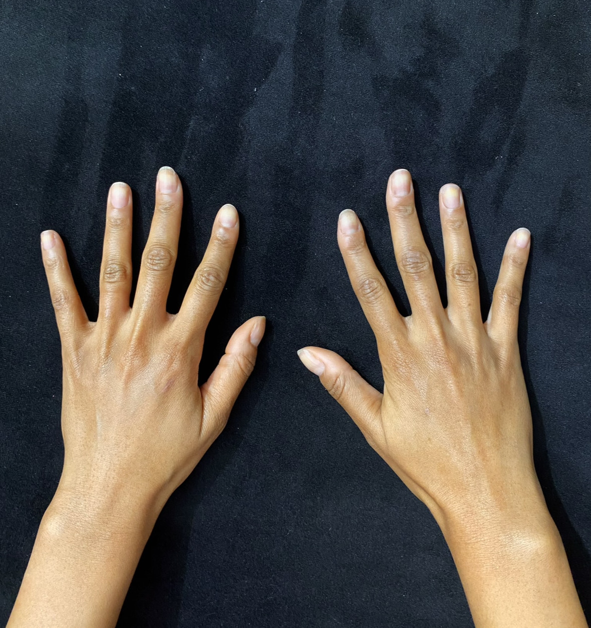 Hand Image