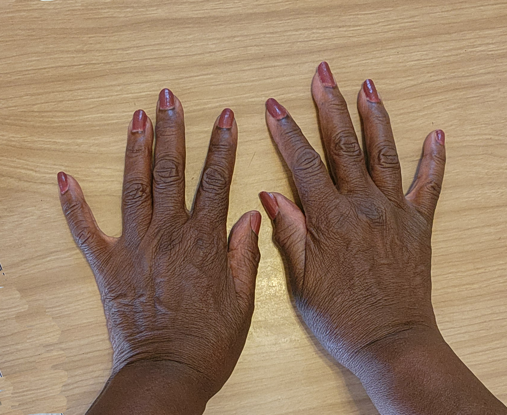 Hand Talent