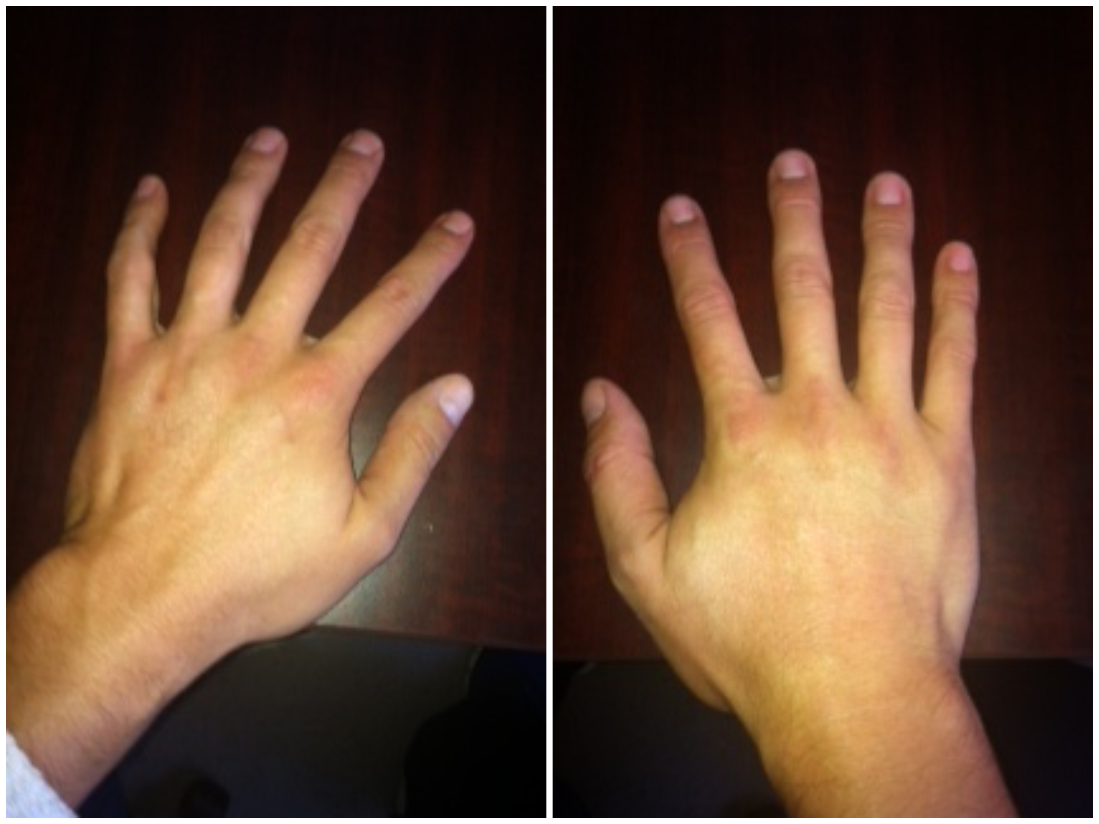 Hand Talent