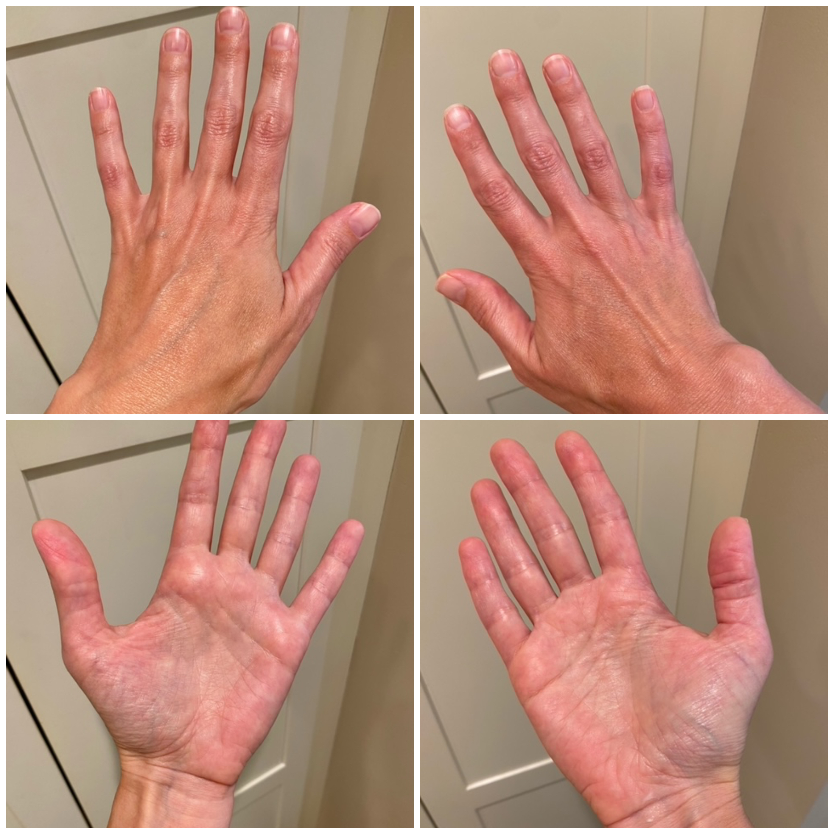 Hand Talent