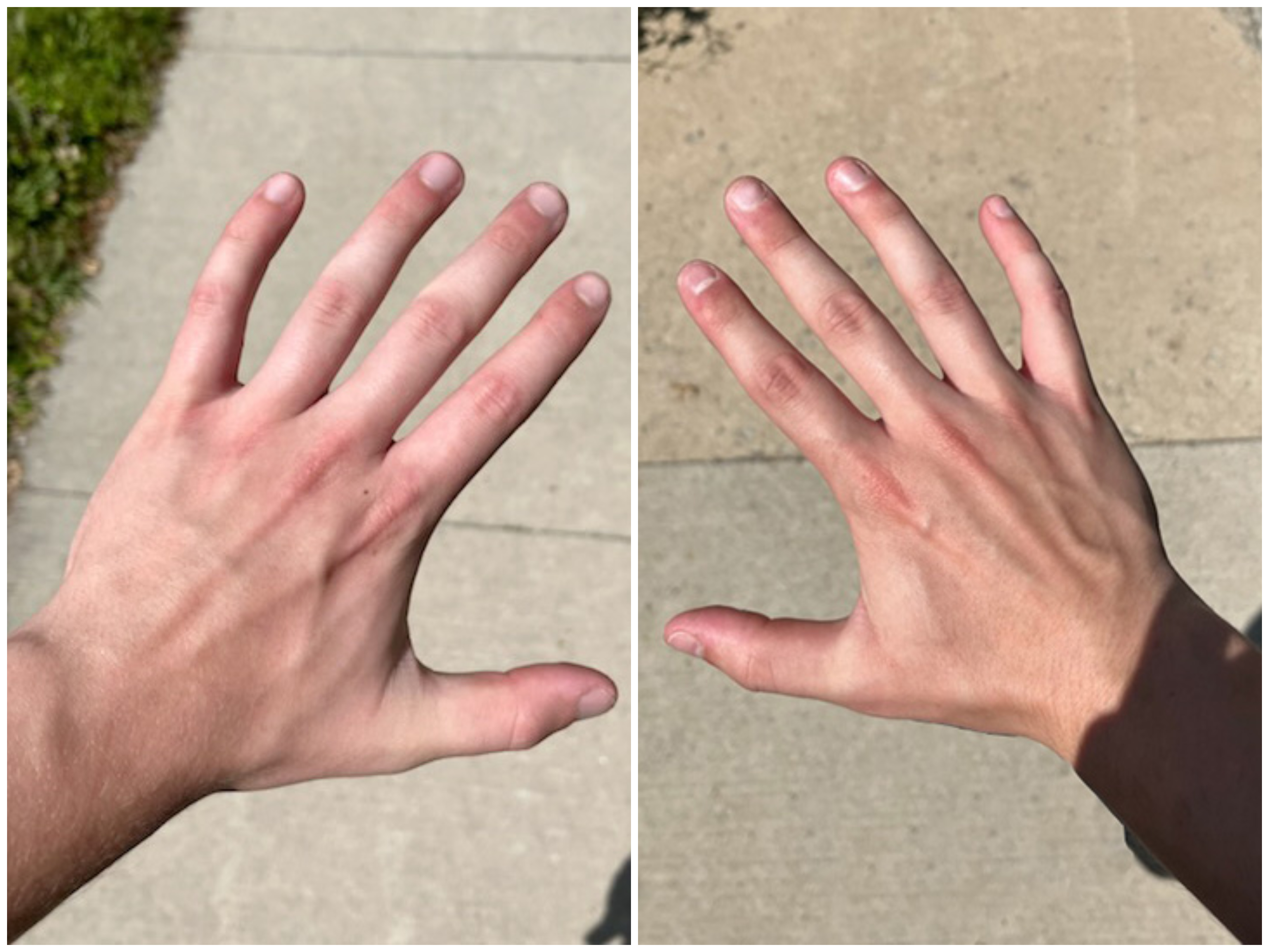 Hand Talent