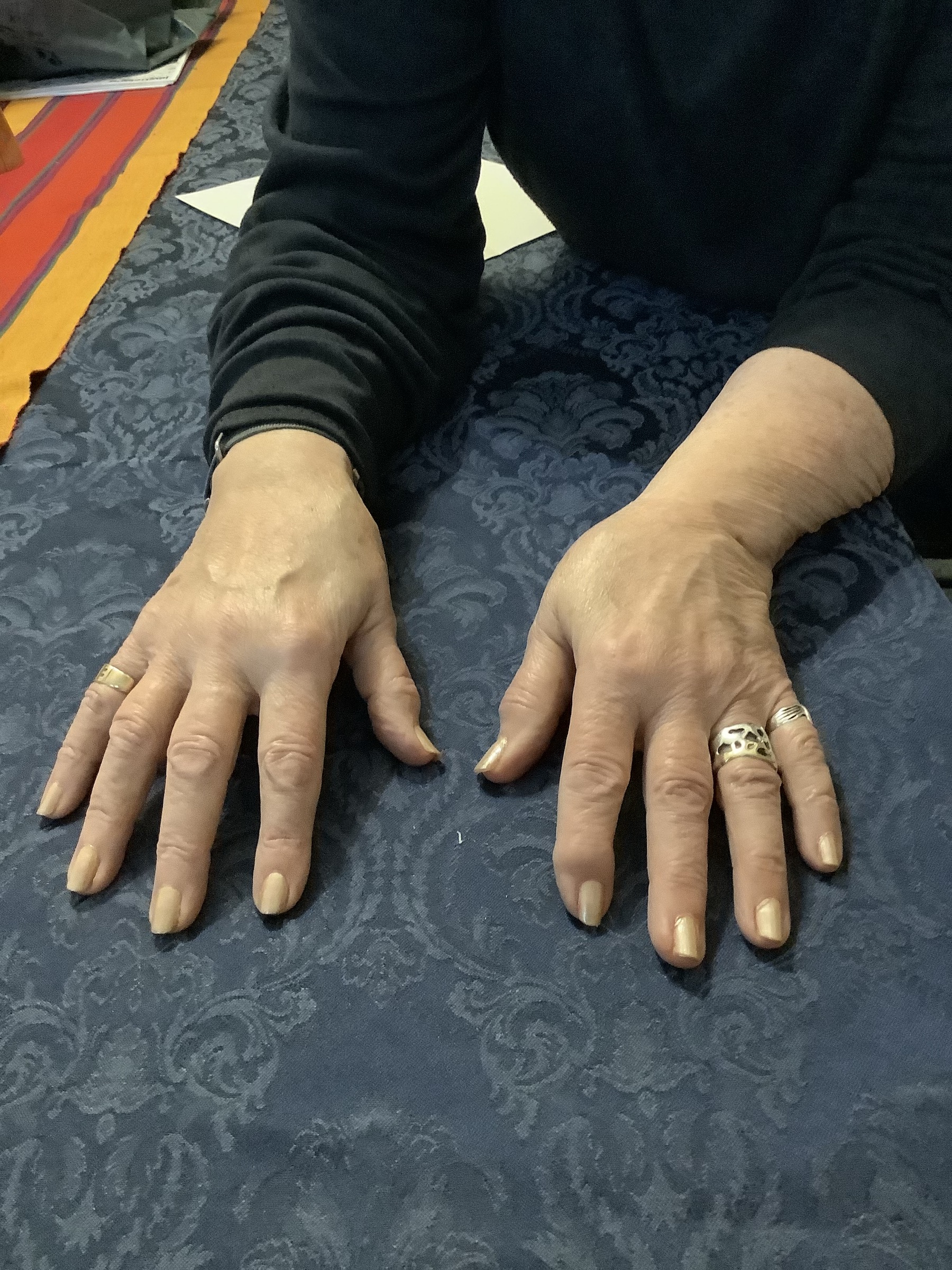 Hand Talent