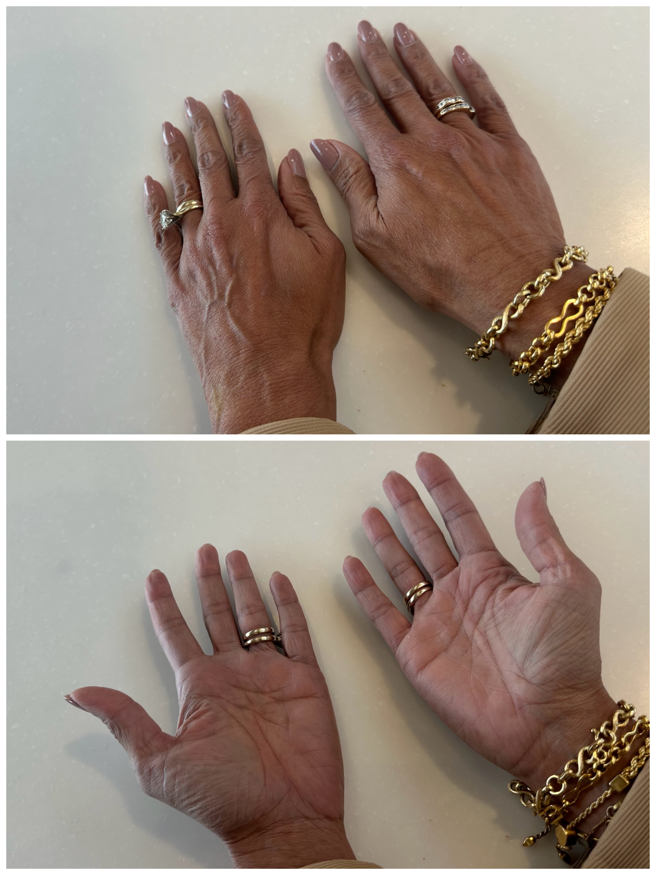 Hand Talent