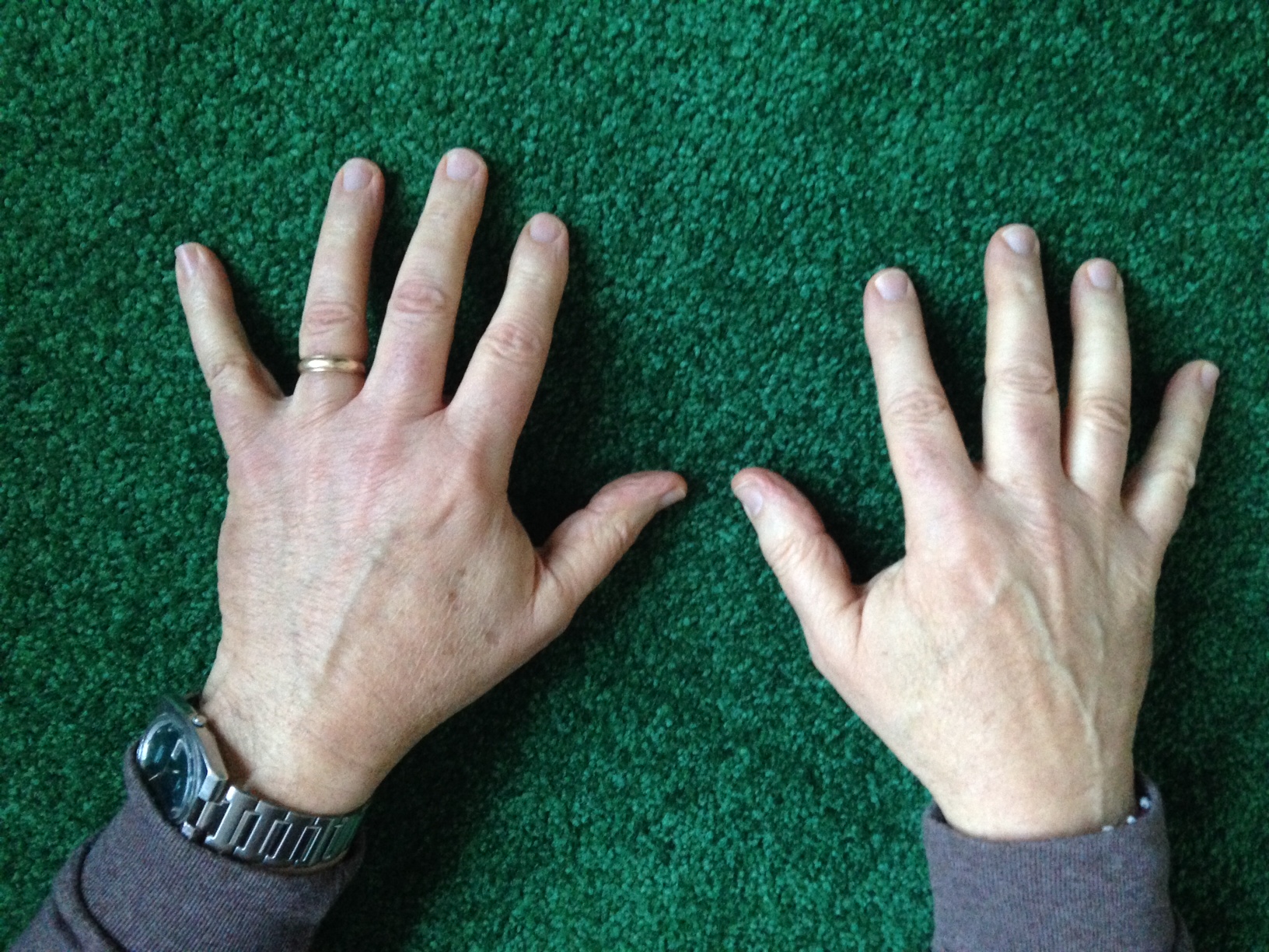 Hand Talent