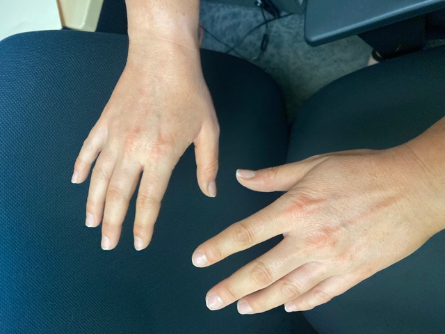 Hand Talent