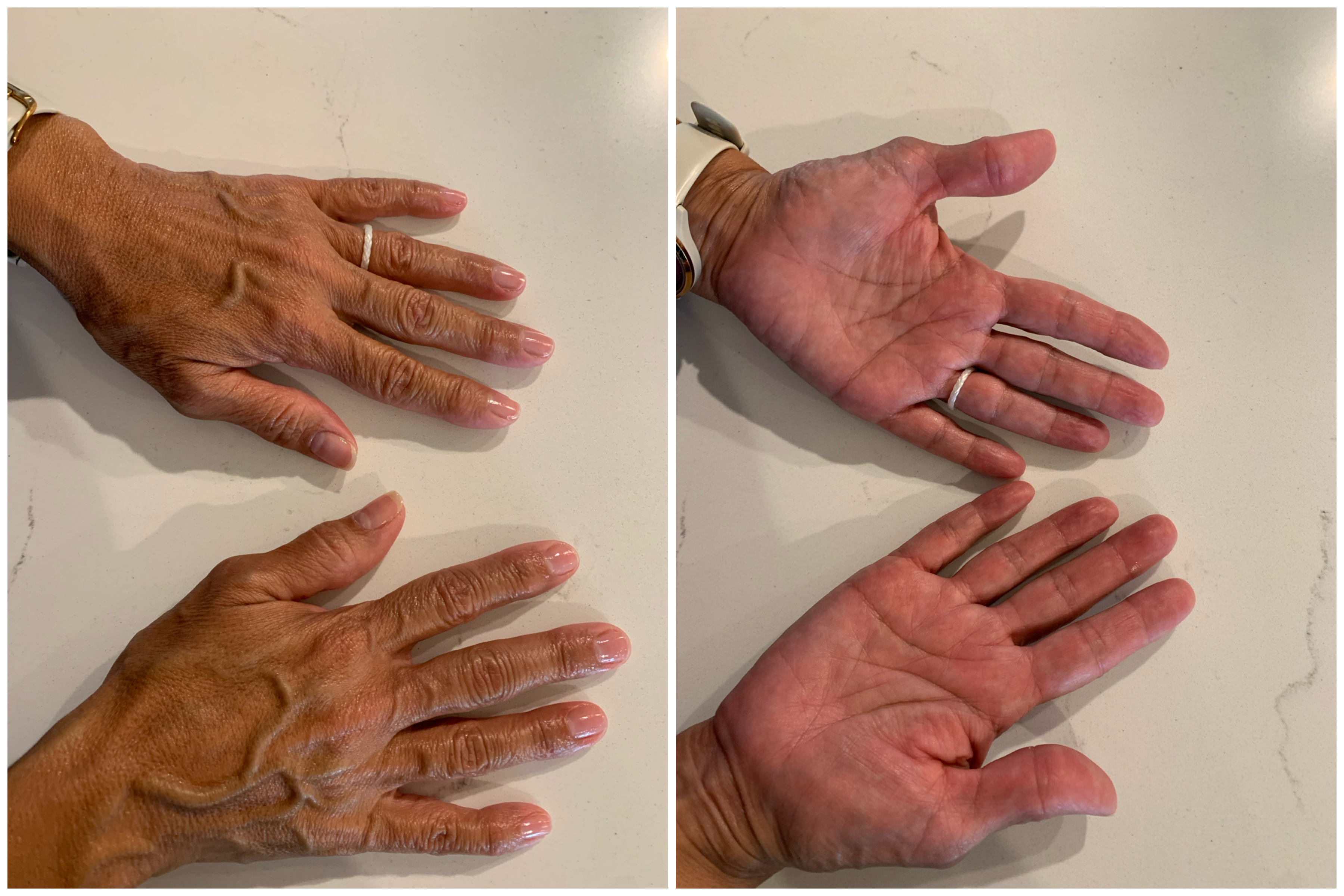 Hand Talent