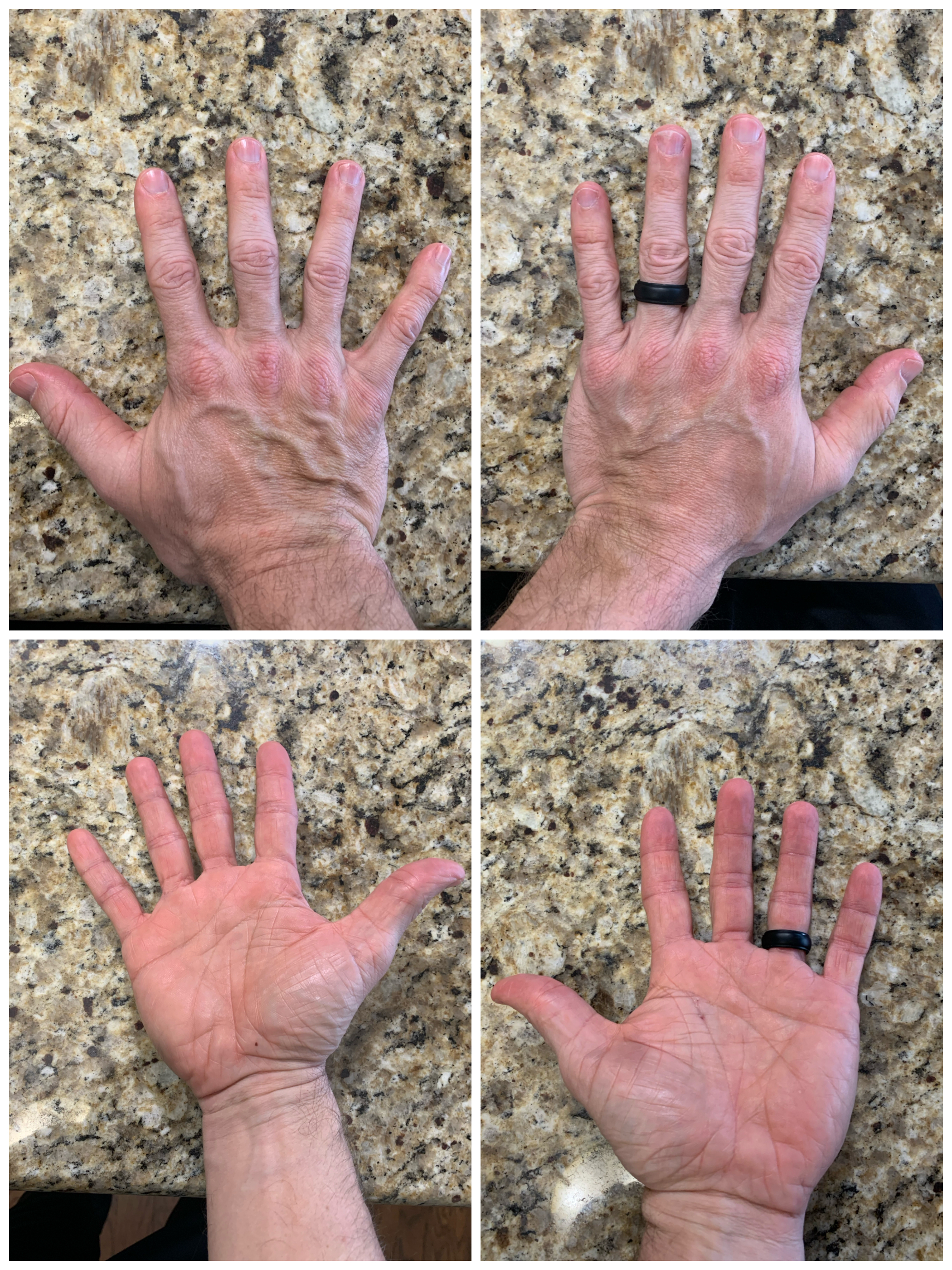 Hand Talent