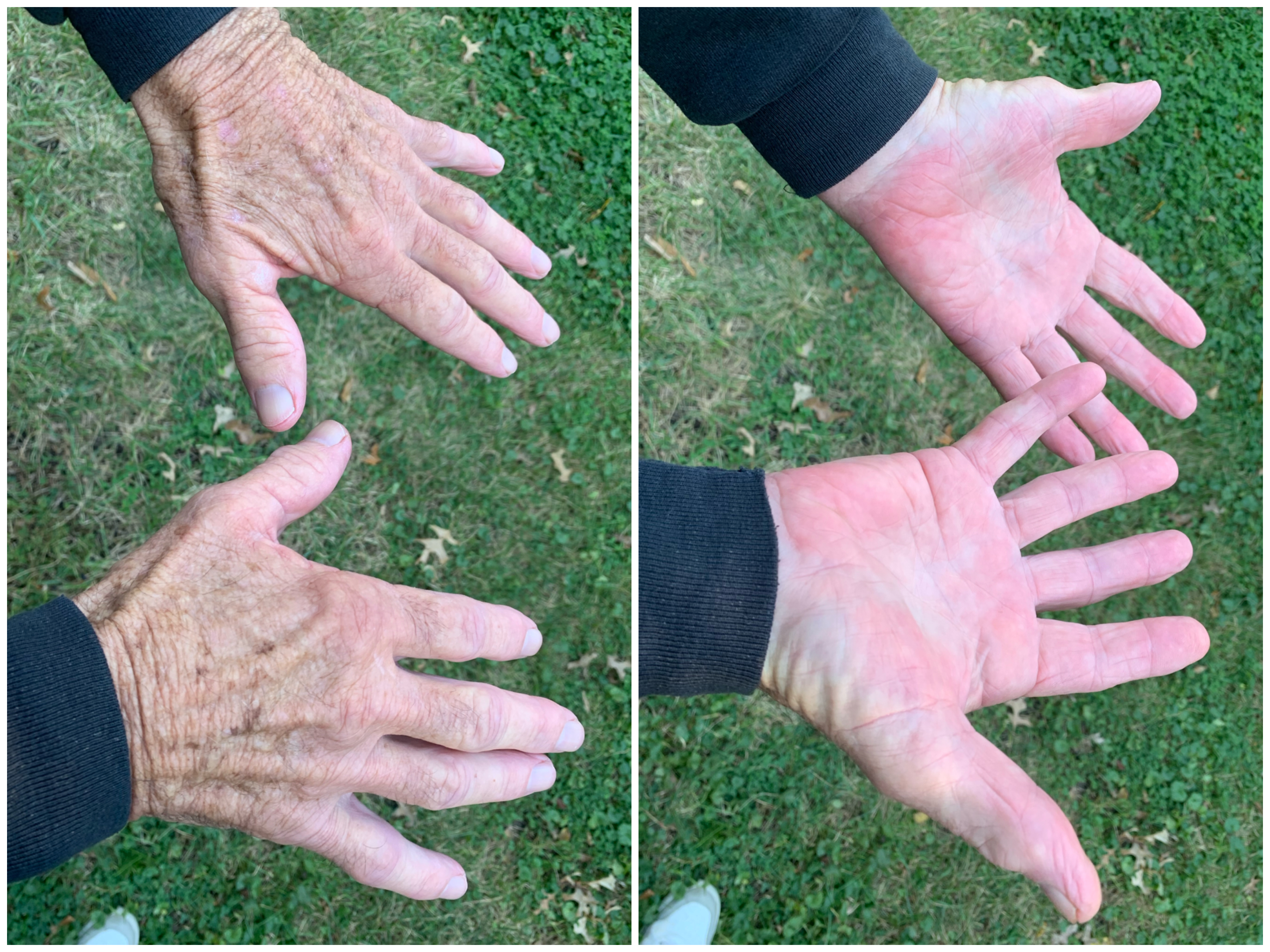 Hand Talent