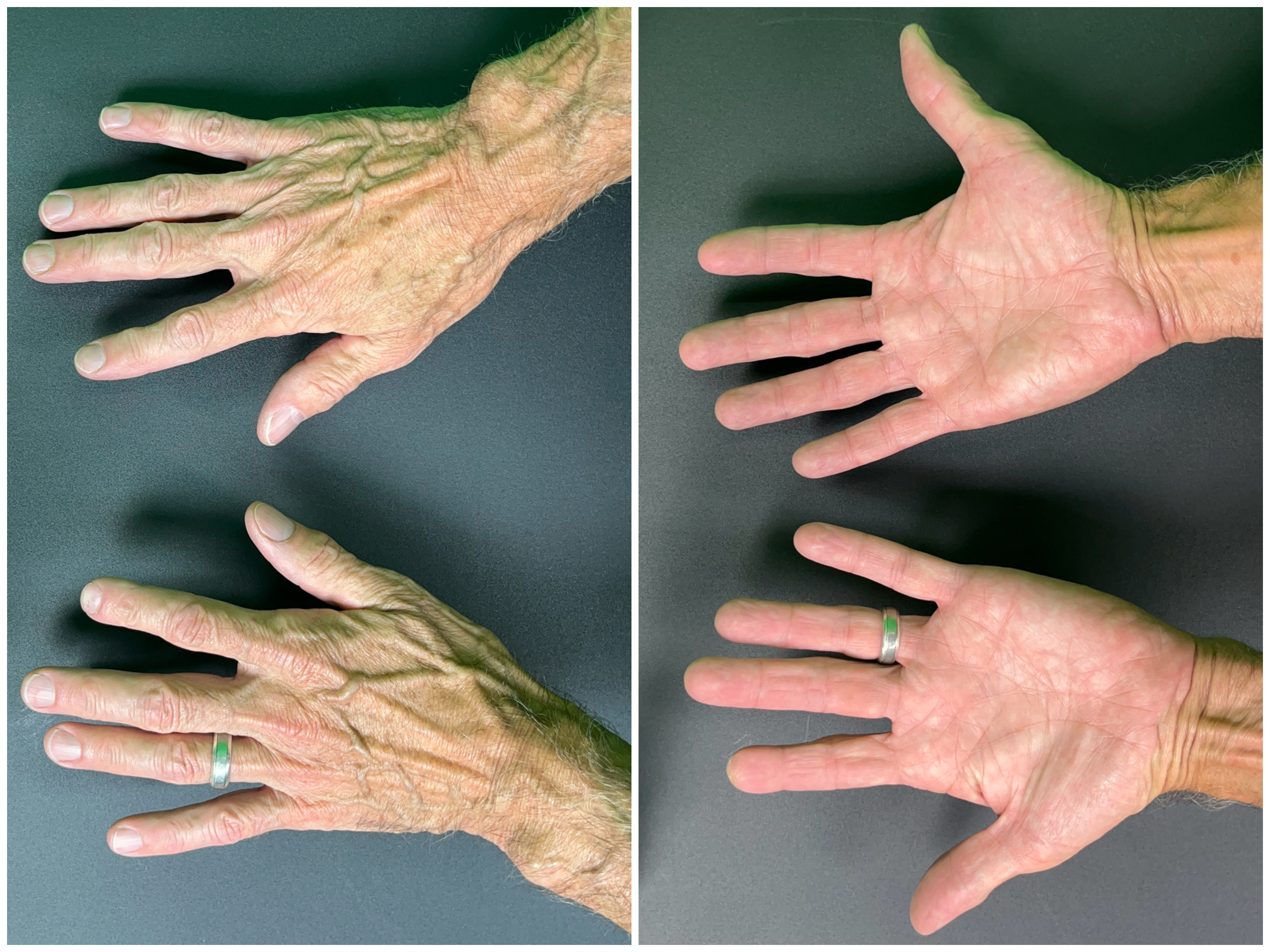 Hand Talent