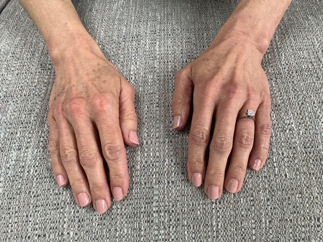 Hand Talent