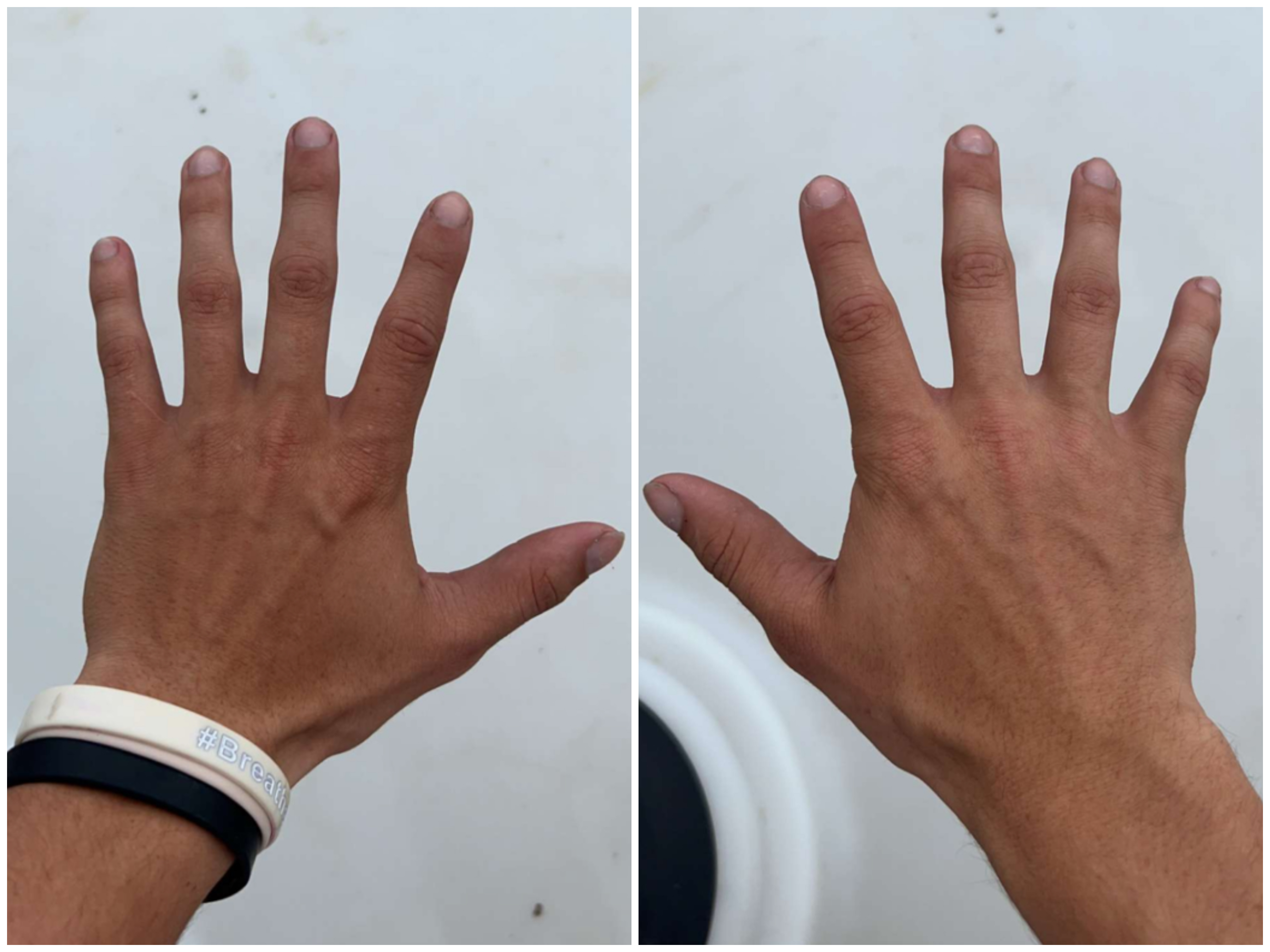 Hand Talent
