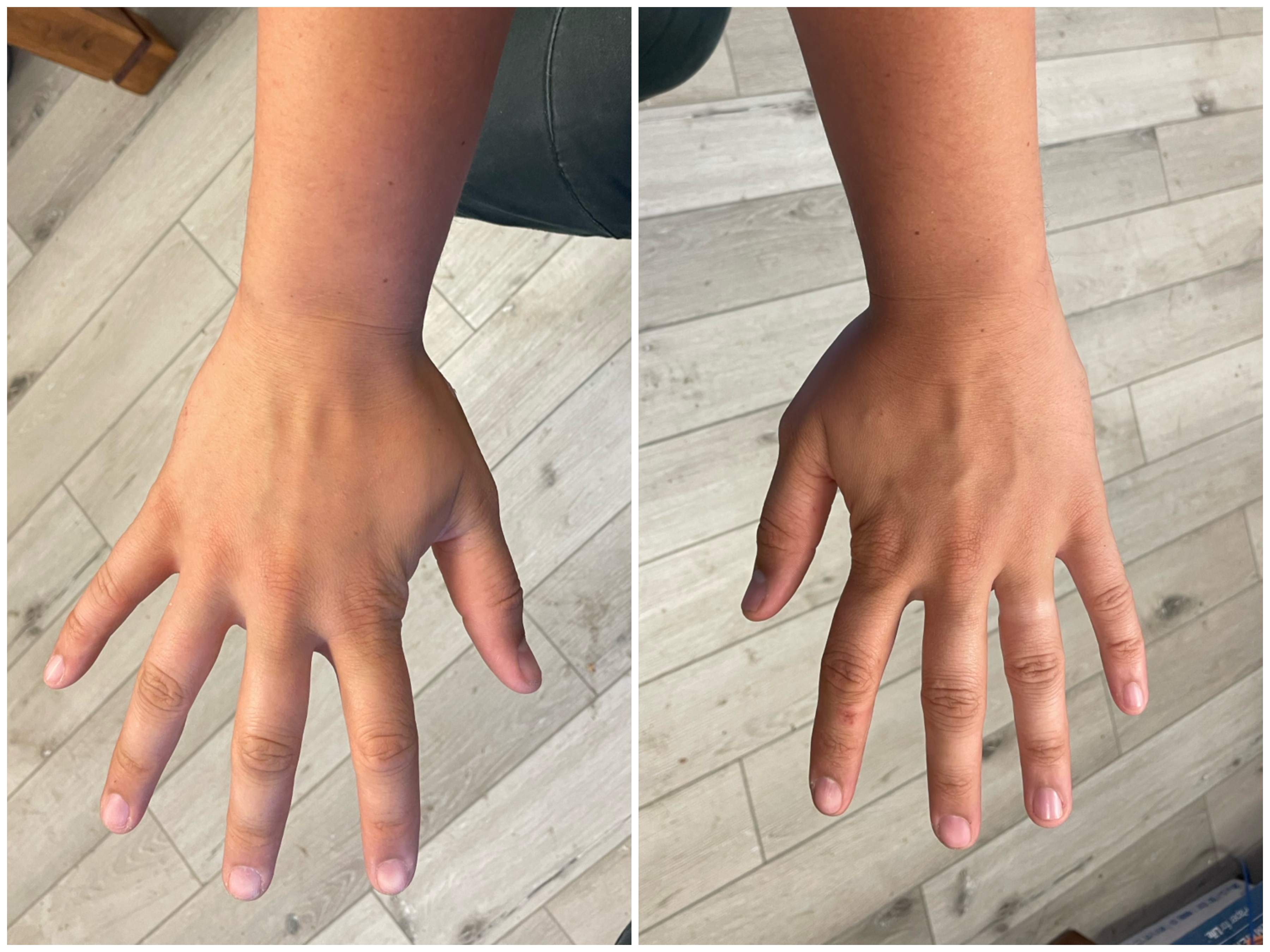 Hand Talent